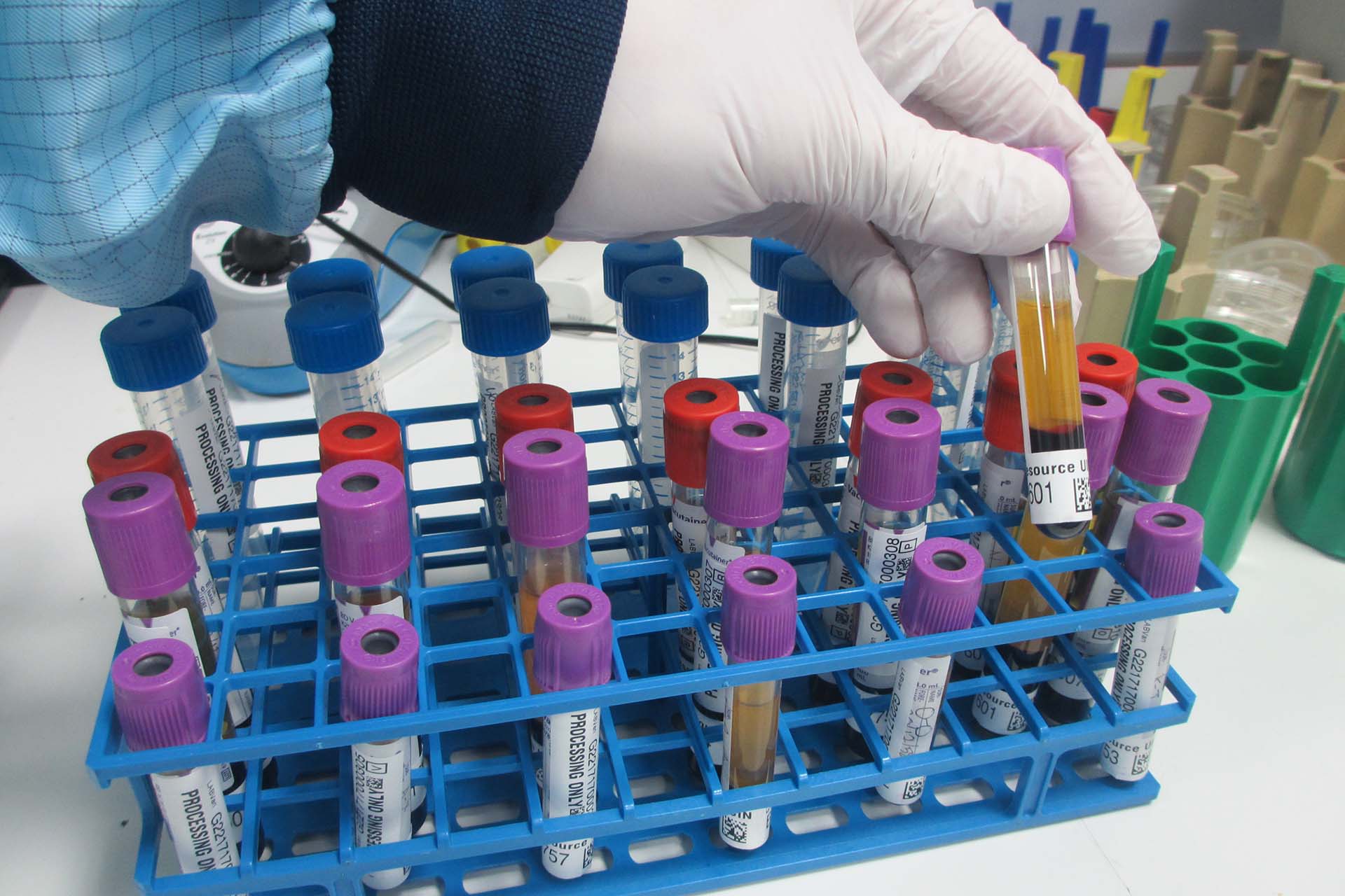 Hand_tubes Blood tubes arranged in a rack